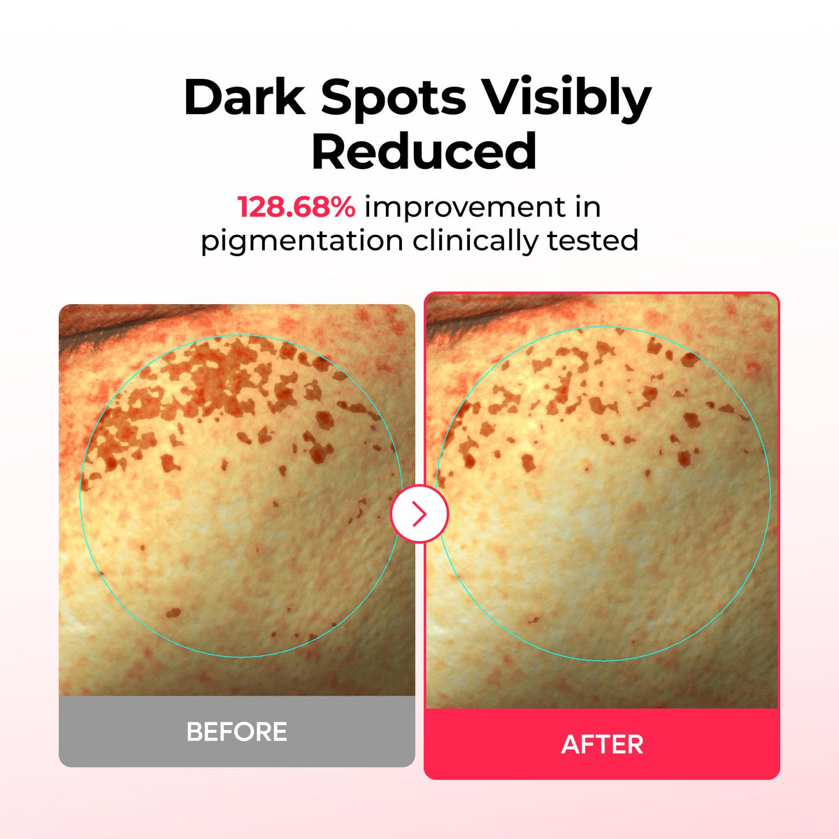 Dr.Melaxin hydrogel close-up texture for cooling adhesion benefit