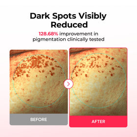 Dr.Melaxin hydrogel close-up texture for cooling adhesion benefit