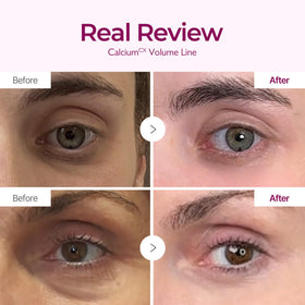 Dr.Melaxin open jar showing creamy contents for lifting and volumizing