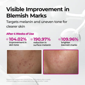 Dr.Melaxin conceptual before and after image showing improved evenness and radiance