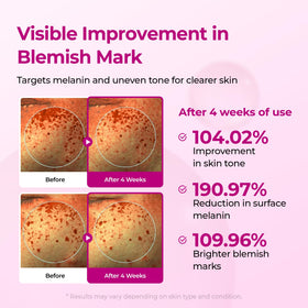 Dr.Melaxin label closeup highlighting alpha‑arbutin and niacinamide ingredients for clarity