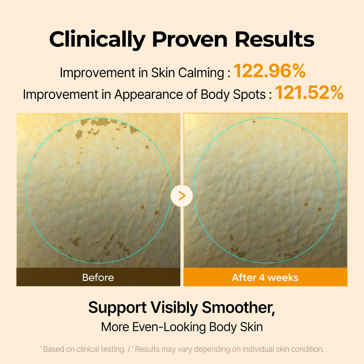 Dr.Melaxin cream being dispensed demonstrating easy application