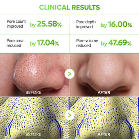 Dr.Melaxin step 3 soothing balm open jar with hydrating finish
