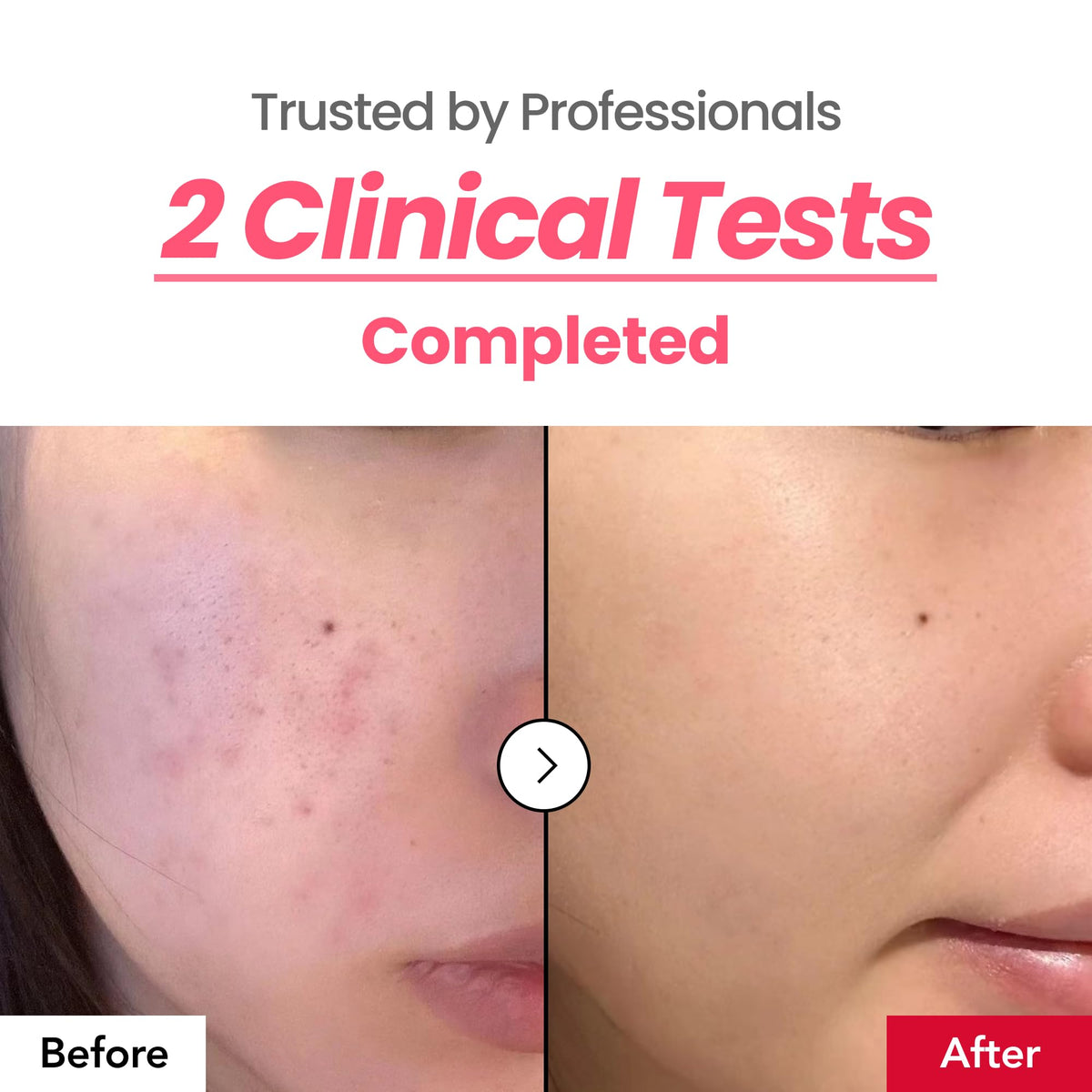 dr.percent premium 7-layer tube packaging protecting actives and preventing oxidation