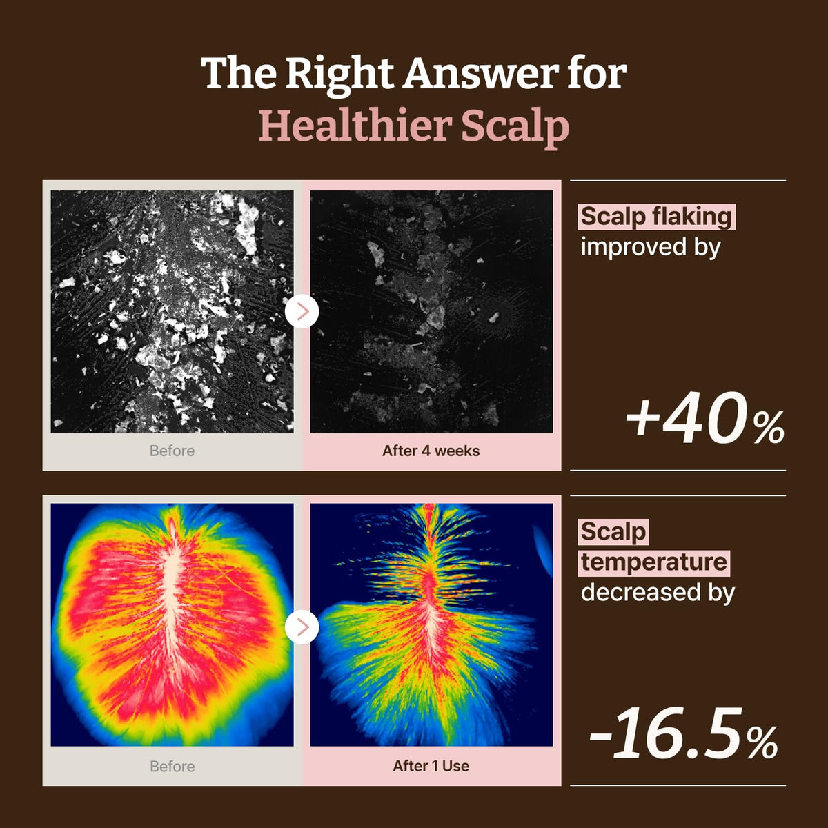 Dr.Reju-All application on scalp in use demonstrating targeted delivery and overnight convenience
