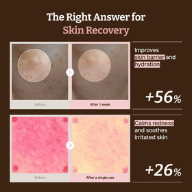 Dr.Reju-All ingredient focus on PDRN vial highlighting purity benefit
