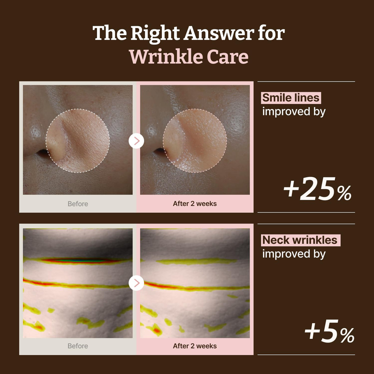 Dr.Reju-All neck sheet detail highlighting targeted coverage and support