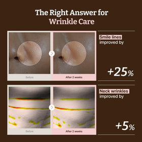 Dr.Reju-All neck sheet detail highlighting targeted coverage and support