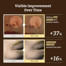 Dr.Reju-All serum on hand to show amount and absorption benefit