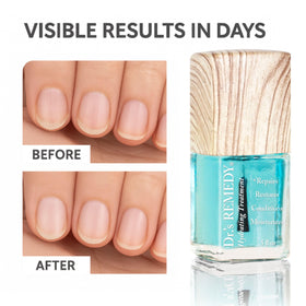 Dr.'s Remedy Total Two-in-One brush and polish photo showing application control and strengthening seal