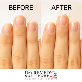 Dr.'s Remedy clear polish texture closeup highlighting high gloss and smooth finish