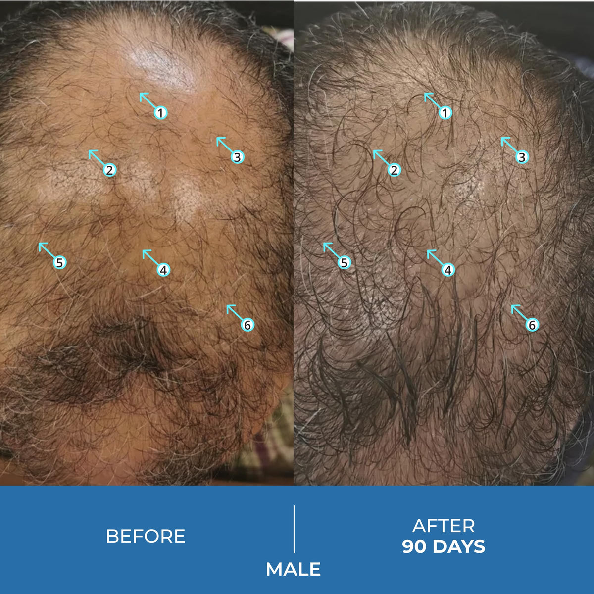 DS Laboratories topical texture on scalp close-up showing fast absorption benefit