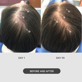 DS Laboratories StimuROLLER being rolled on scalp demonstrating application before serum