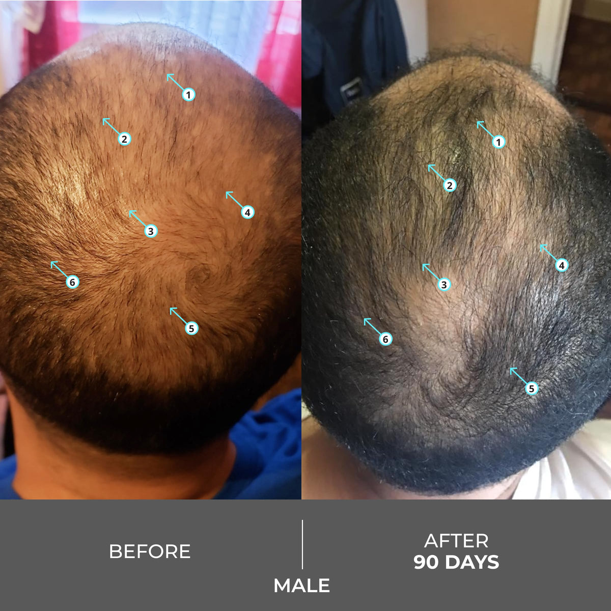 DS Laboratories in-shower lather demonstrating gentle scalp cleanse benefit