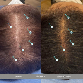 DS Laboratories serum applied to scalp demonstrating easy targeted application benefit