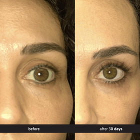 DS Laboratories serum being applied to upper lash base for targeted daily use