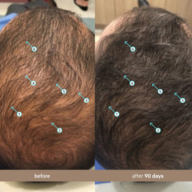 DS Laboratories scalp application on crown area, shows easy daily use for fuller look