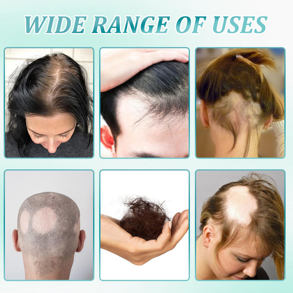 dssuoa illustrative before and after hair improvement visualization