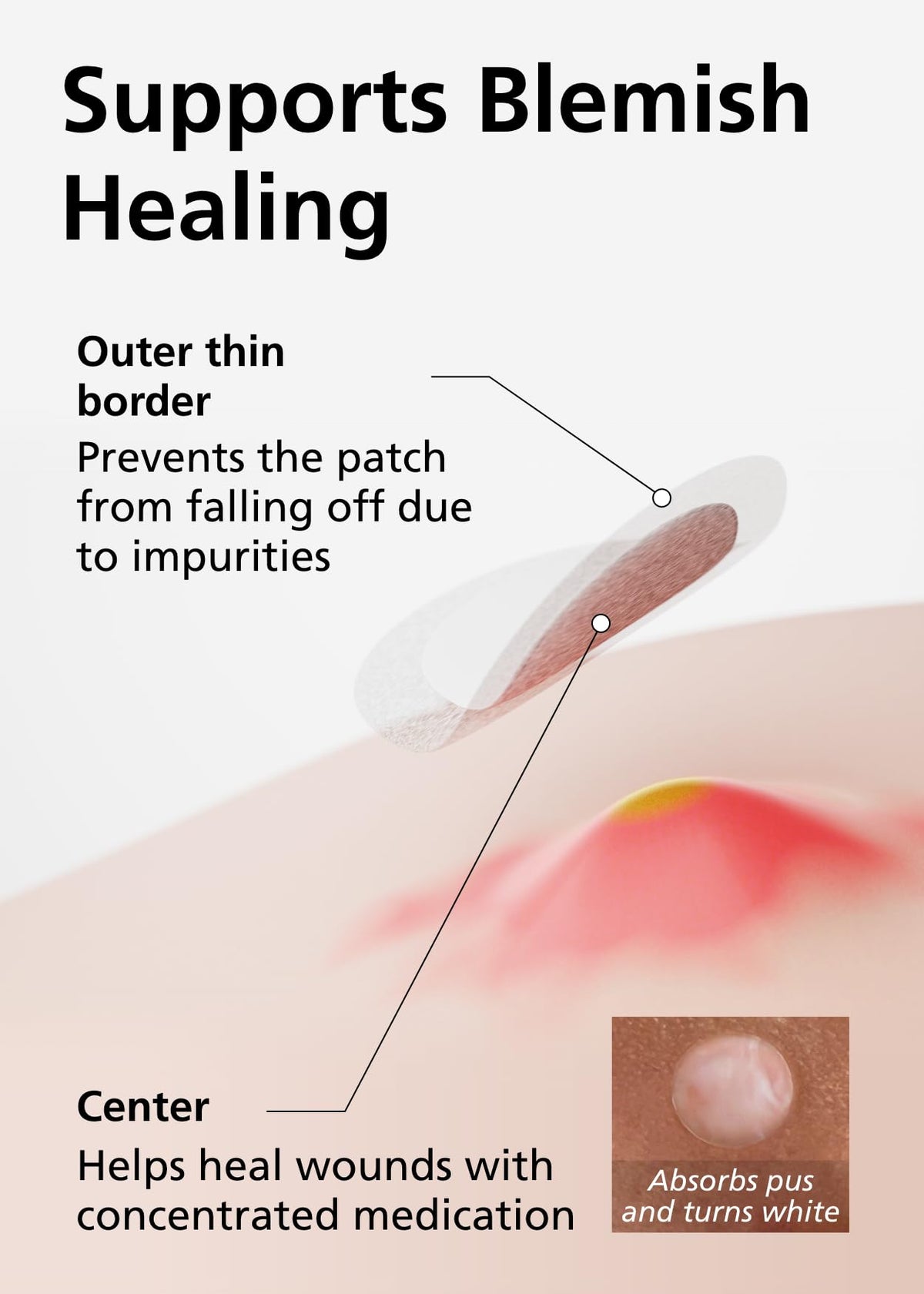 DWEasyDerm patch texture macro revealing thin hydrocolloid and discreet look
