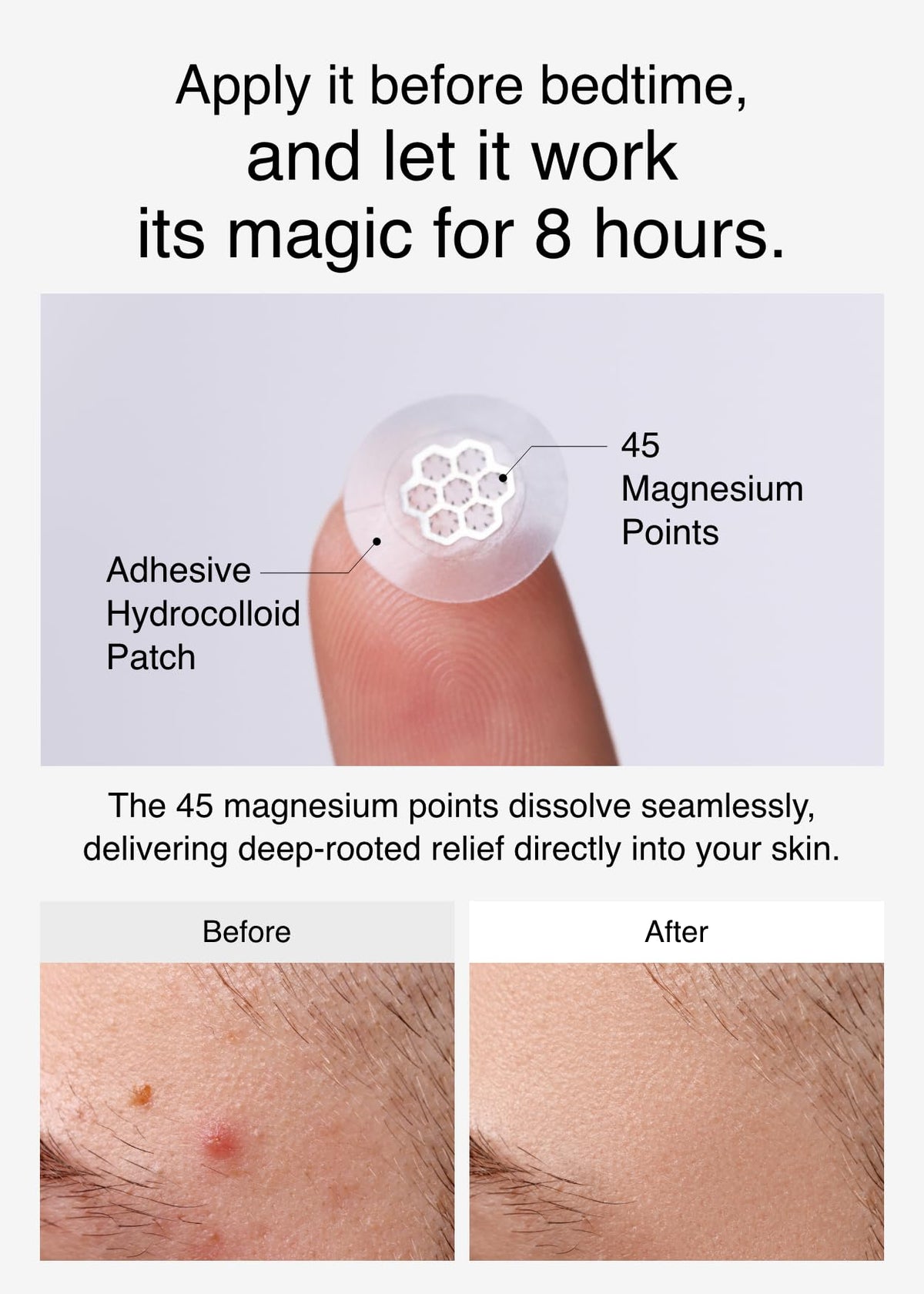 DWEasyDerm tweezers holding a patch for hygienic placement benefit