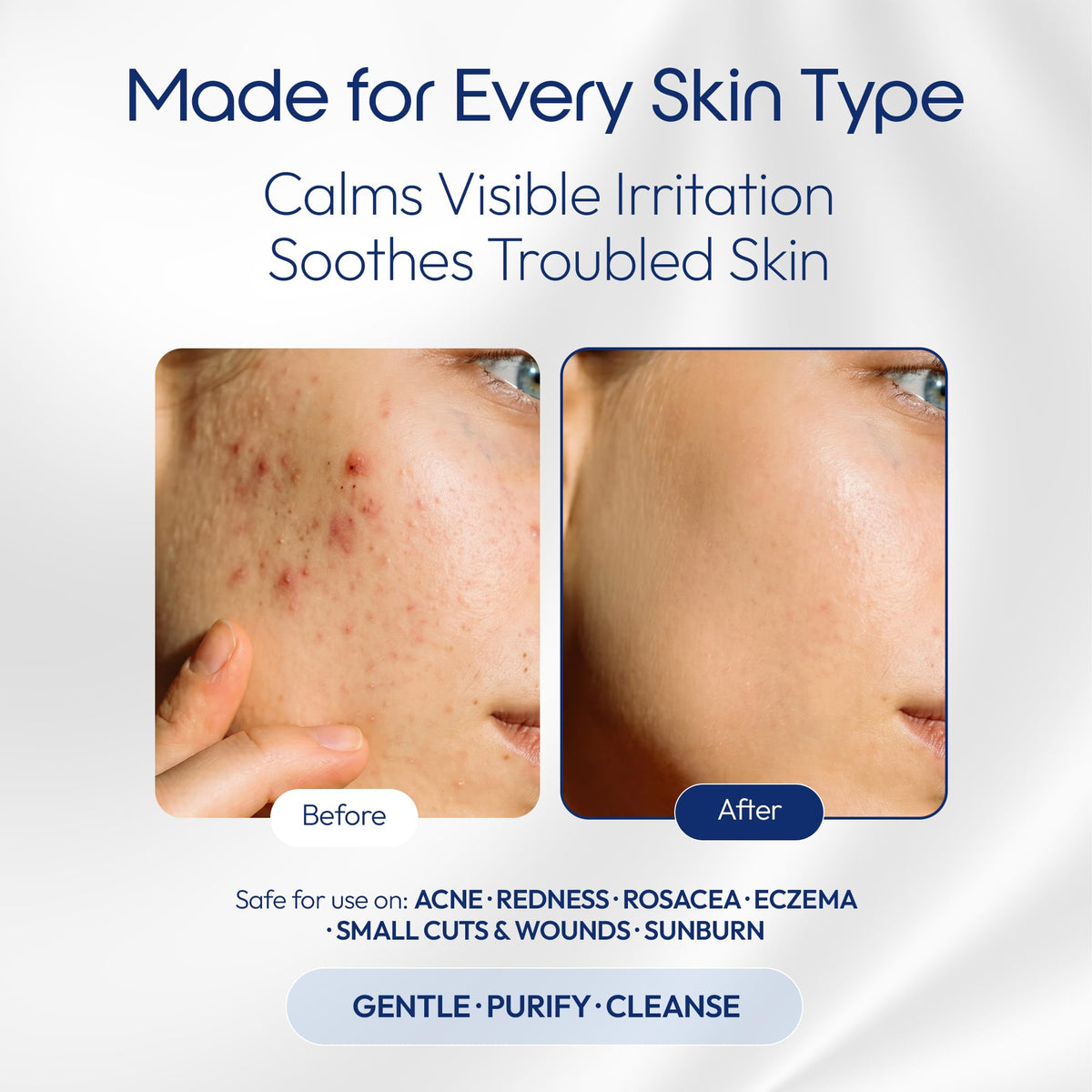 e11ement applied to tattoo area shows gentle cleansing benefit