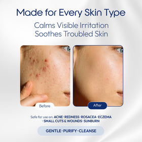 e11ement applied to tattoo area shows gentle cleansing benefit