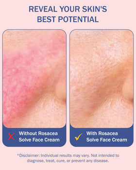 e70 applied to damp face during morning routine for reduced redness
