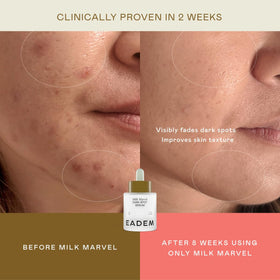 EADEM Milk Marvel texture on hand demonstrating lightweight, non-greasy feel
