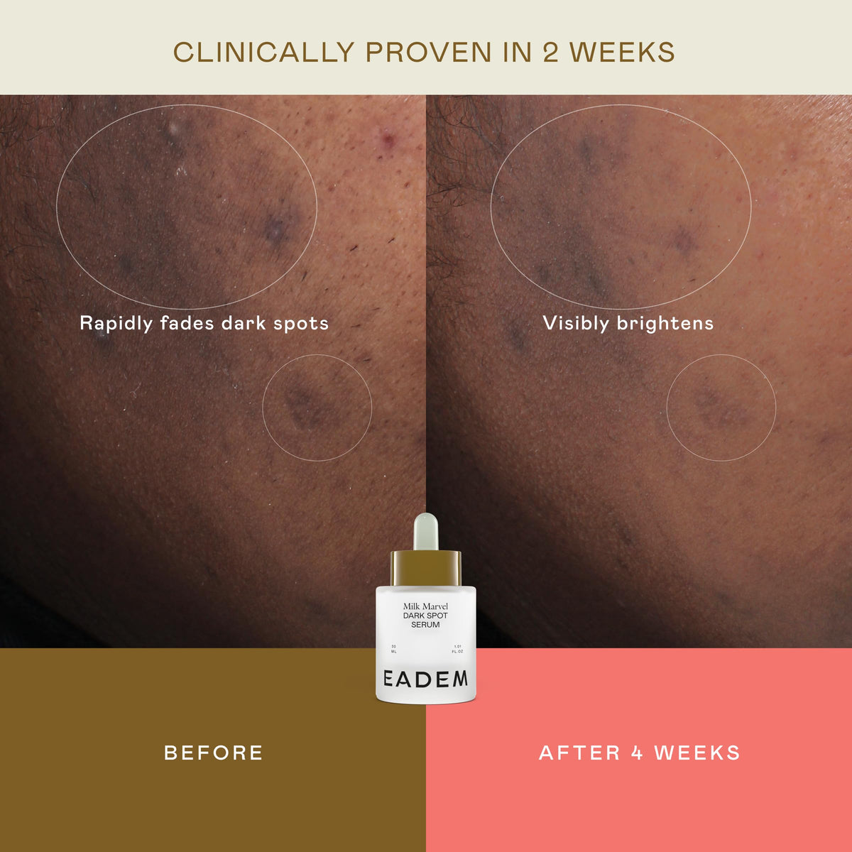 EADEM Milk Marvel applied to cheek illustrating targeted dark spot treatment