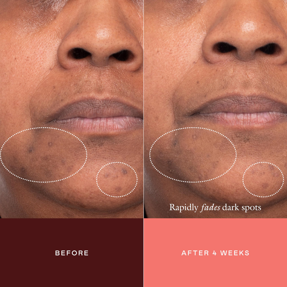 EADEM product applied on a spot illustrating localized treatment effectiveness