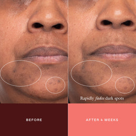 EADEM product applied on a spot illustrating localized treatment effectiveness