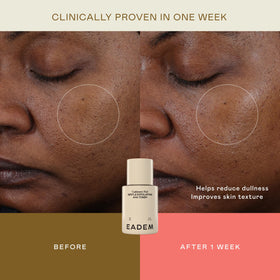 EADEM toner on a cotton pad showing gentle, hydrating exfoliation