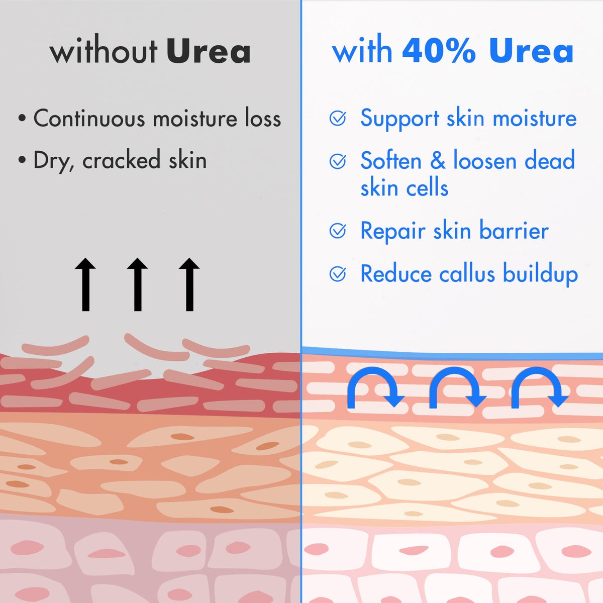 Ebanel before and after feet comparison showing smoother skin