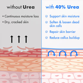 Ebanel before and after feet comparison showing smoother skin