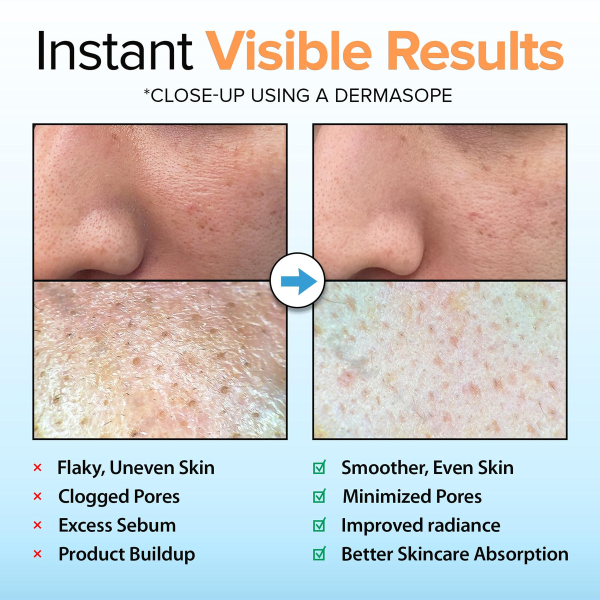 Ebanel cellulose micro-rolls close-up demonstrating gentle exfoliation visually
