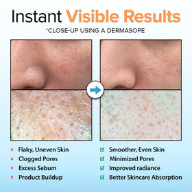 Ebanel cellulose micro-rolls close-up demonstrating gentle exfoliation visually