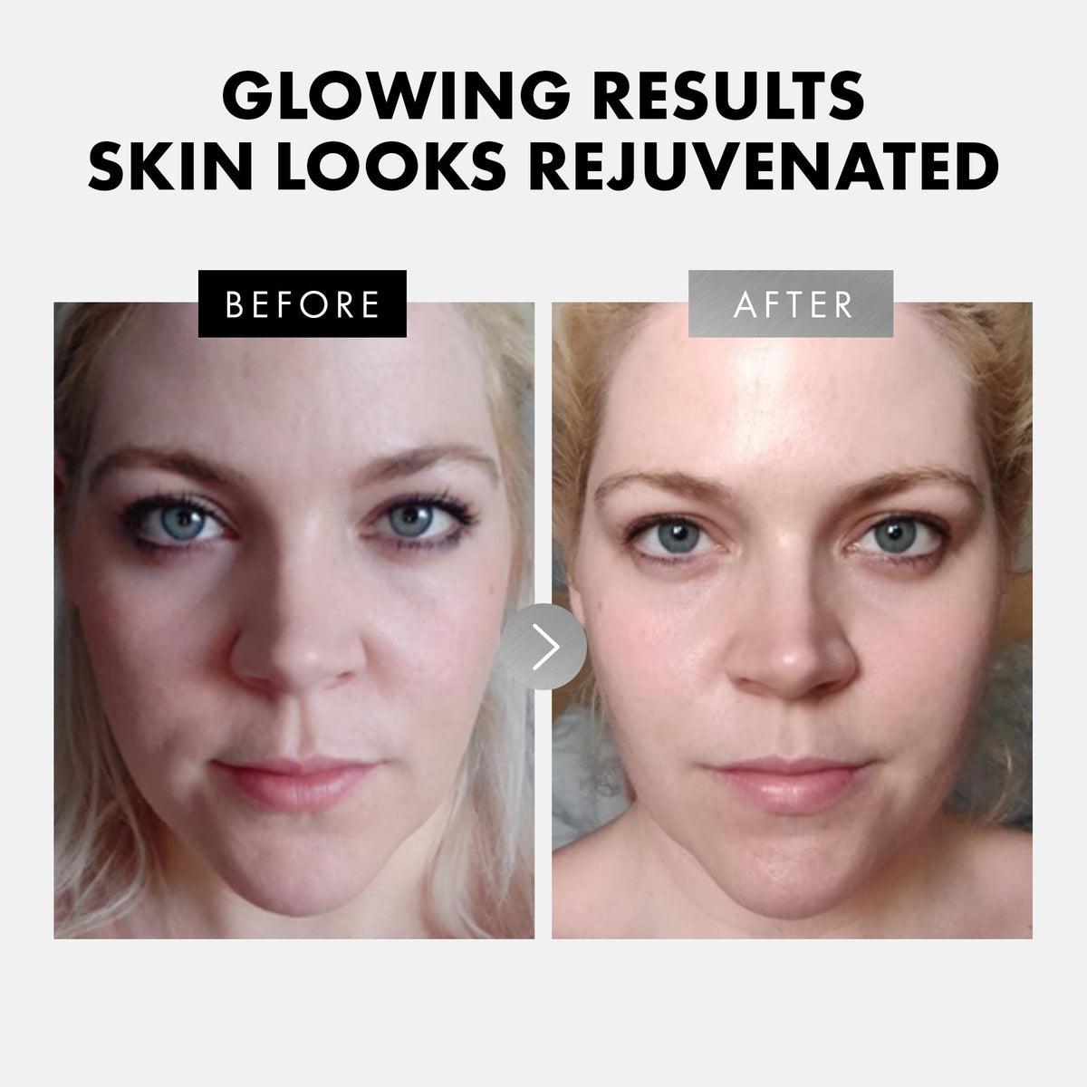 Eclat Skincare retinol serum amber bottle label highlighting renewal benefits