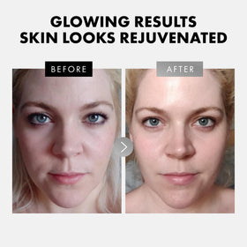 Eclat Skincare retinol serum amber bottle label highlighting renewal benefits