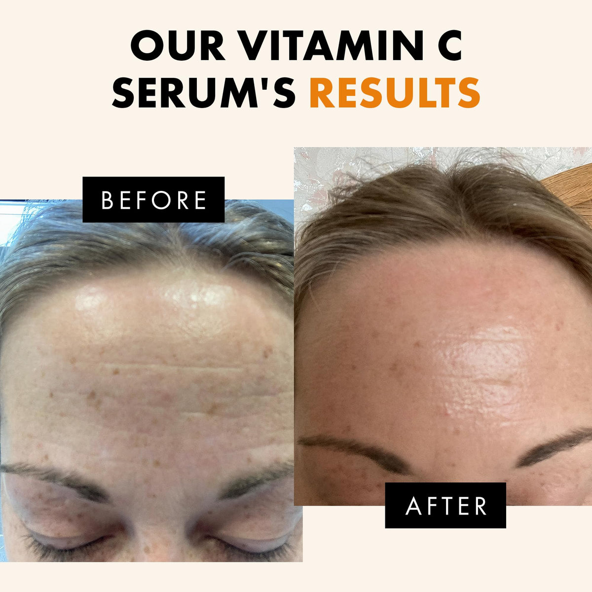 Eclat Skincare ingredient lineup with hyaluronic acid and vitamin C for brightening benefits