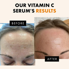 Eclat Skincare ingredient lineup with hyaluronic acid and vitamin C for brightening benefits