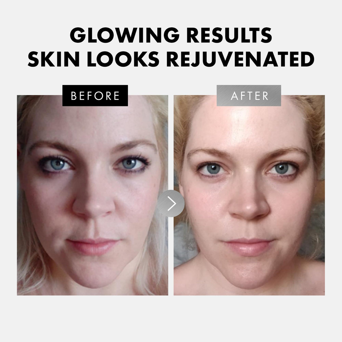 Eclat Skincare hyaluronic texture drop highlighting hydration and plumping