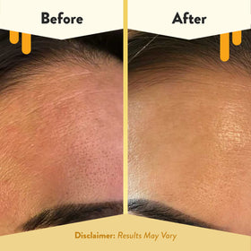 ECZEMA HONEY bottle with colloidal oatmeal and aloe visual to show calming ingredients