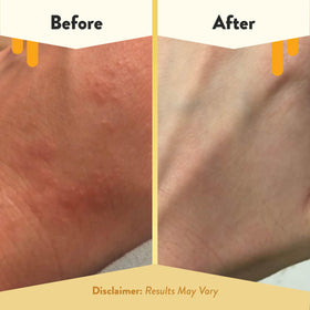 ECZEMA HONEY ingredients label highlighting colloidal oatmeal and organic honey