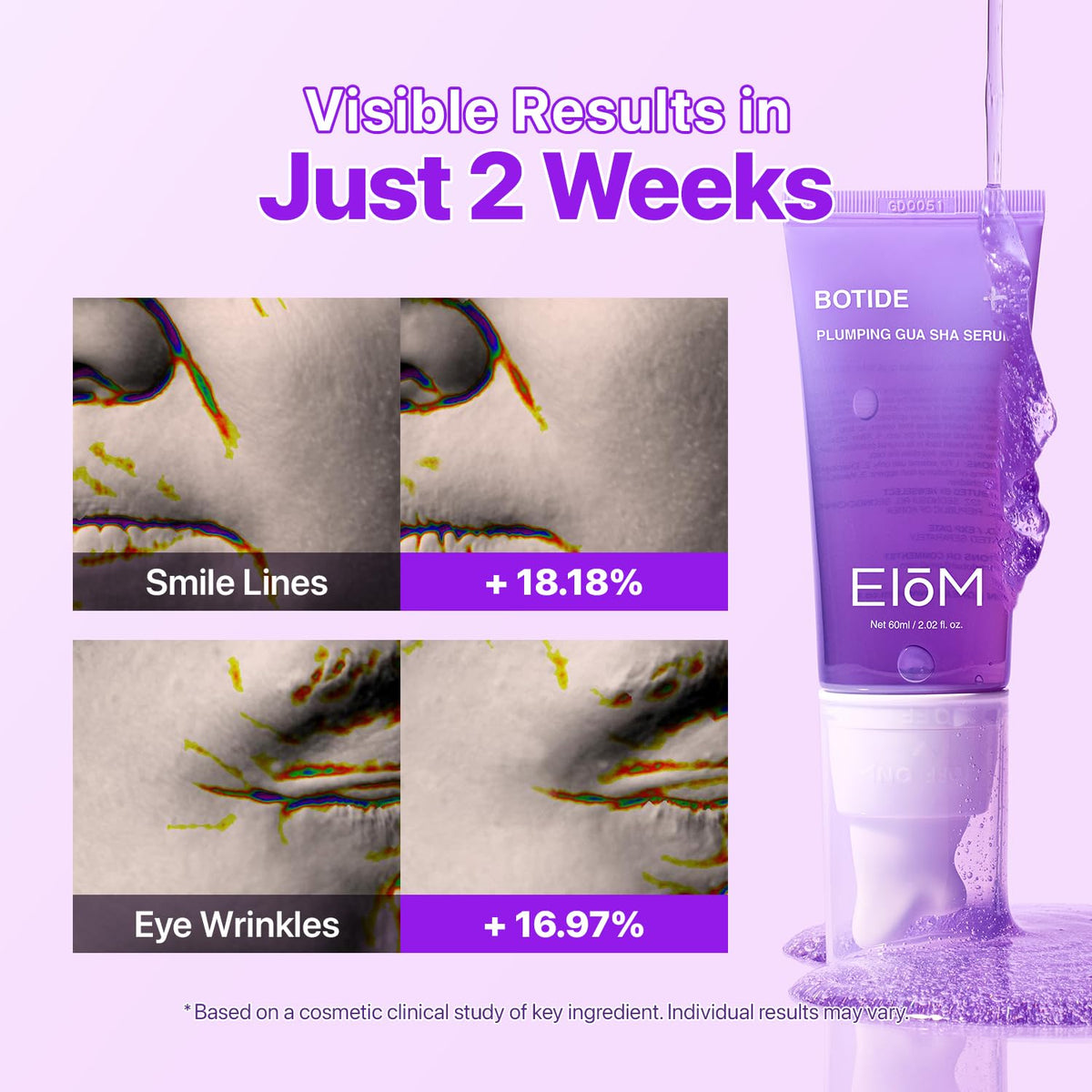 EIOM glide along jawline and neck showing lift and contouring benefit