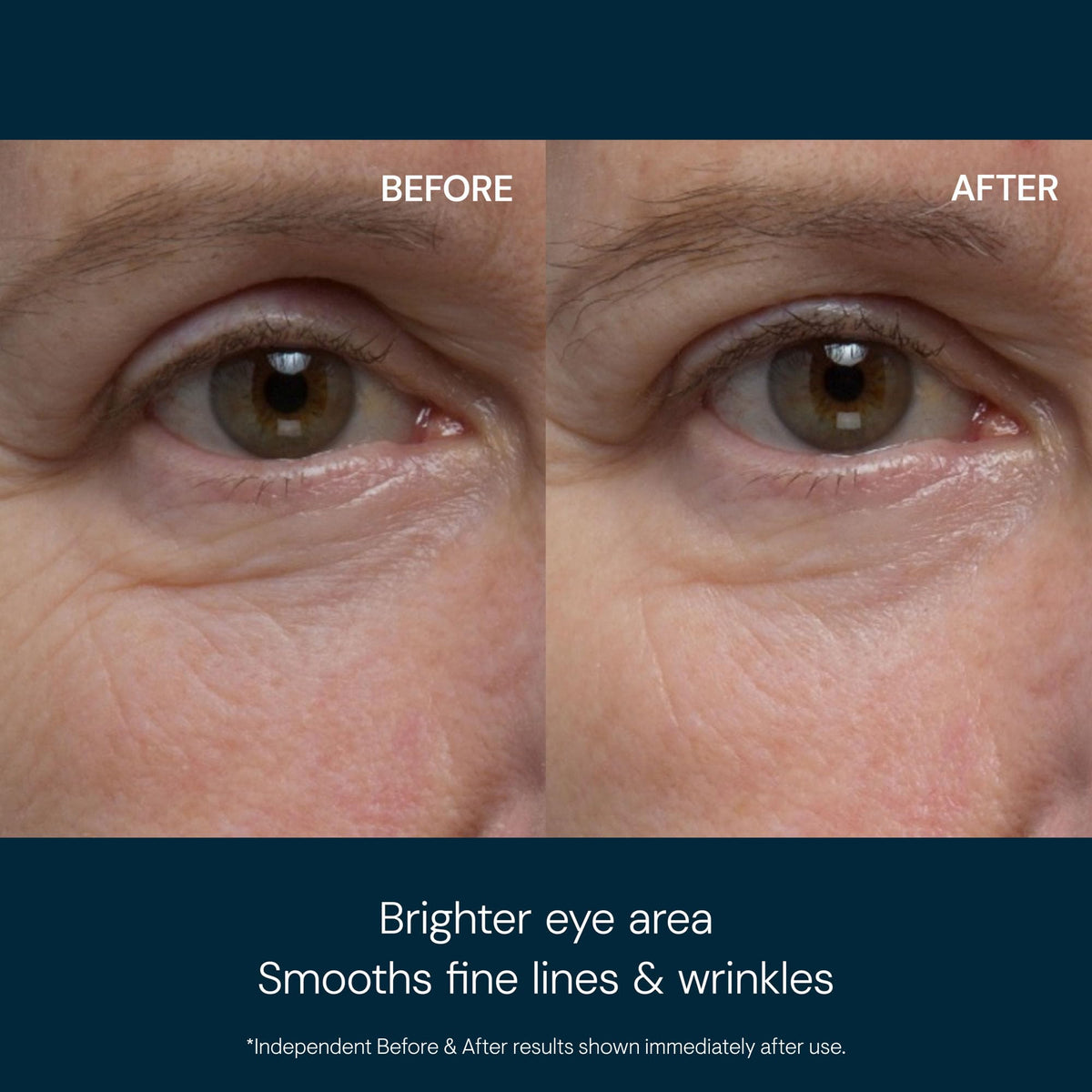 ELEMIS gel texture close-up with cooling sheen, demonstrating lightweight hydration and smooth finish