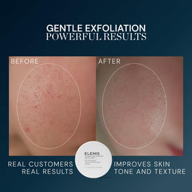 ELEMIS pad soaked with essence on fingers demonstrating controlled, no‑rinse application