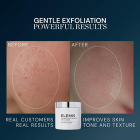 ELEMIS soaked pad detail showing solution saturation that delivers chemical exfoliation benefits
