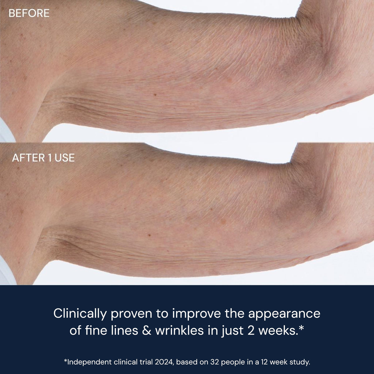 ELEMIS applying cream to hand demonstrating quick absorption benefit