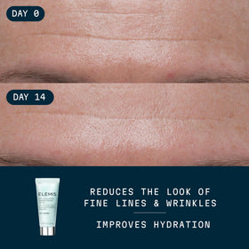 ELEMIS close-up gel-cream texture demonstrating lightweight hydration