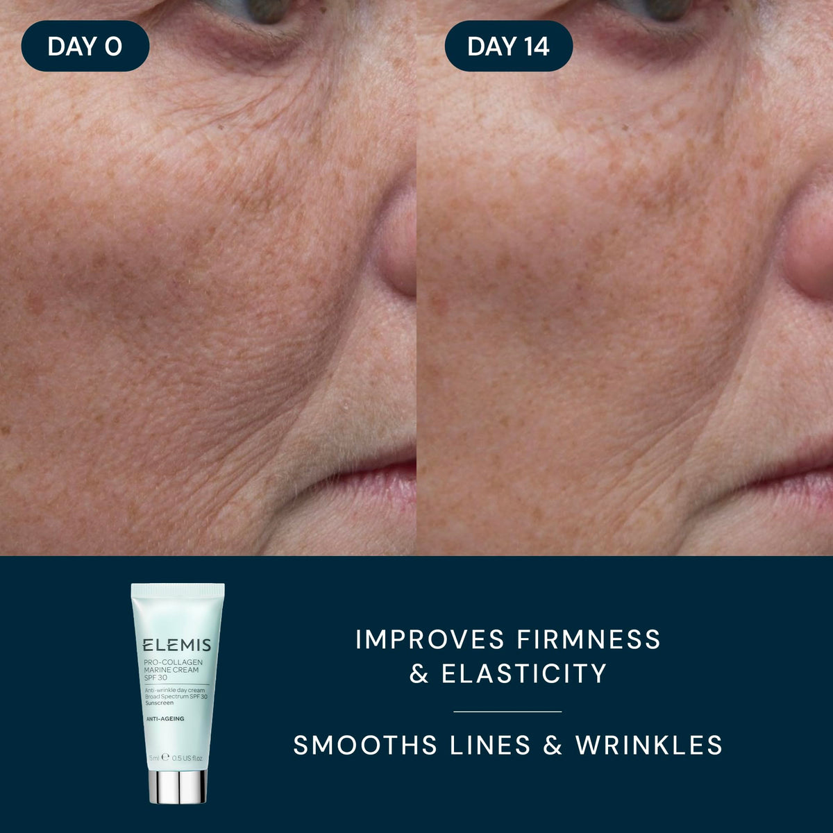 ELEMIS resurfacing pad applied to cheek showing exfoliation for smoother texture